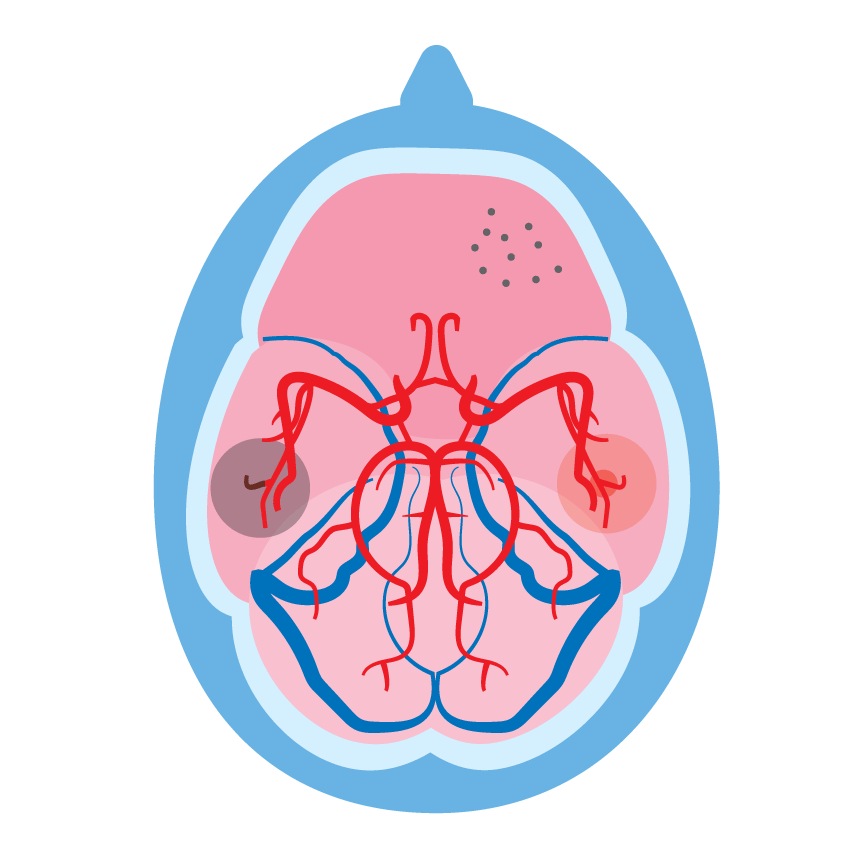 Final version of brain illustration